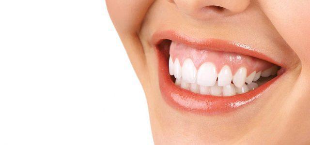 Sonrisa gingival: causas y soluciones - Foto