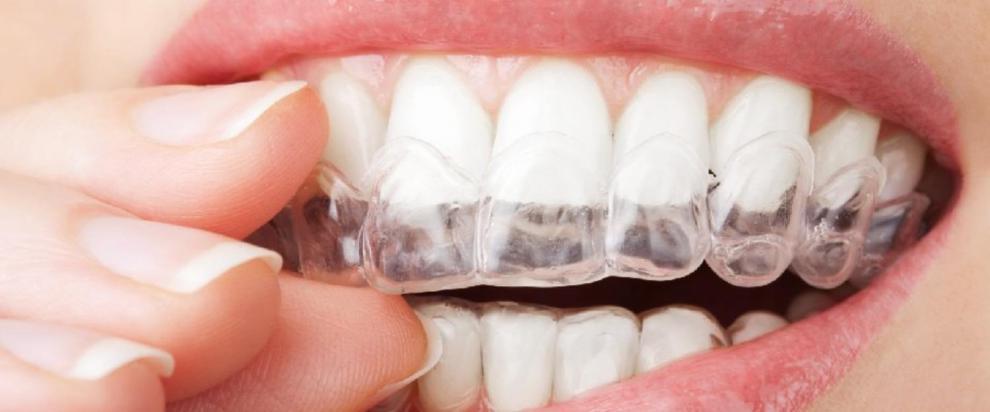 F�rulas de descarga: �cu�ndo son recomendables? - Foto