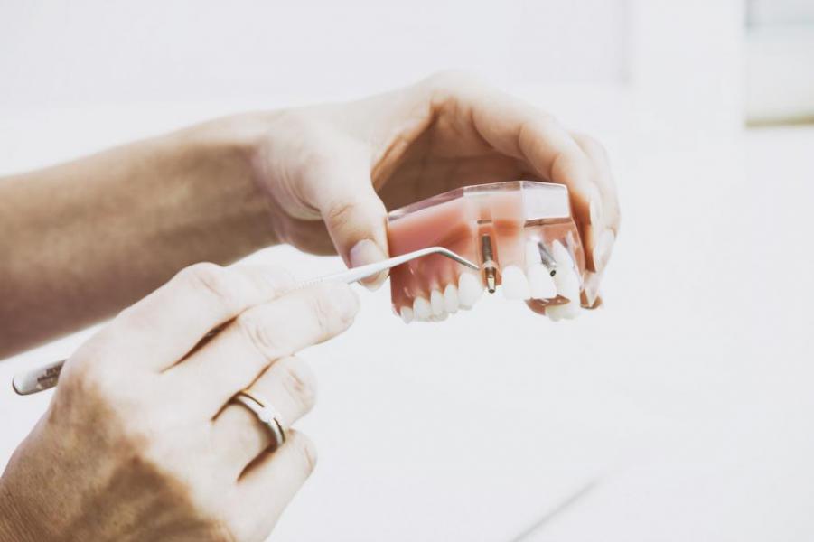 �Son dolorosos los tratamientos de colocaci�n de implantes dentales? - Foto